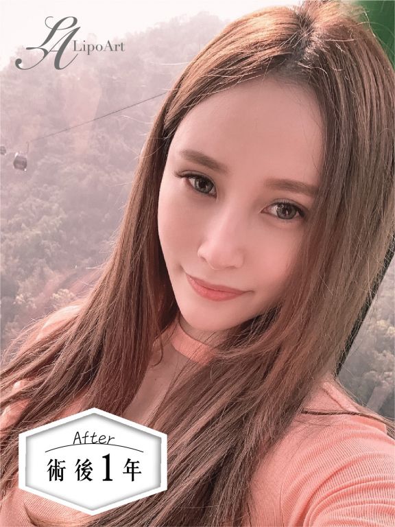 萊波亞