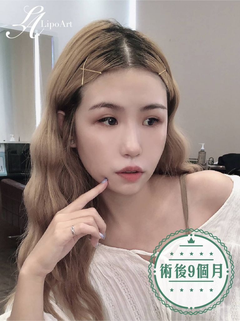 萊波亞
