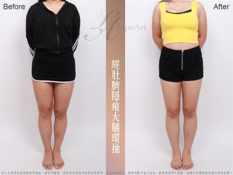 萊波亞 