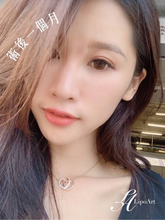 萊波亞