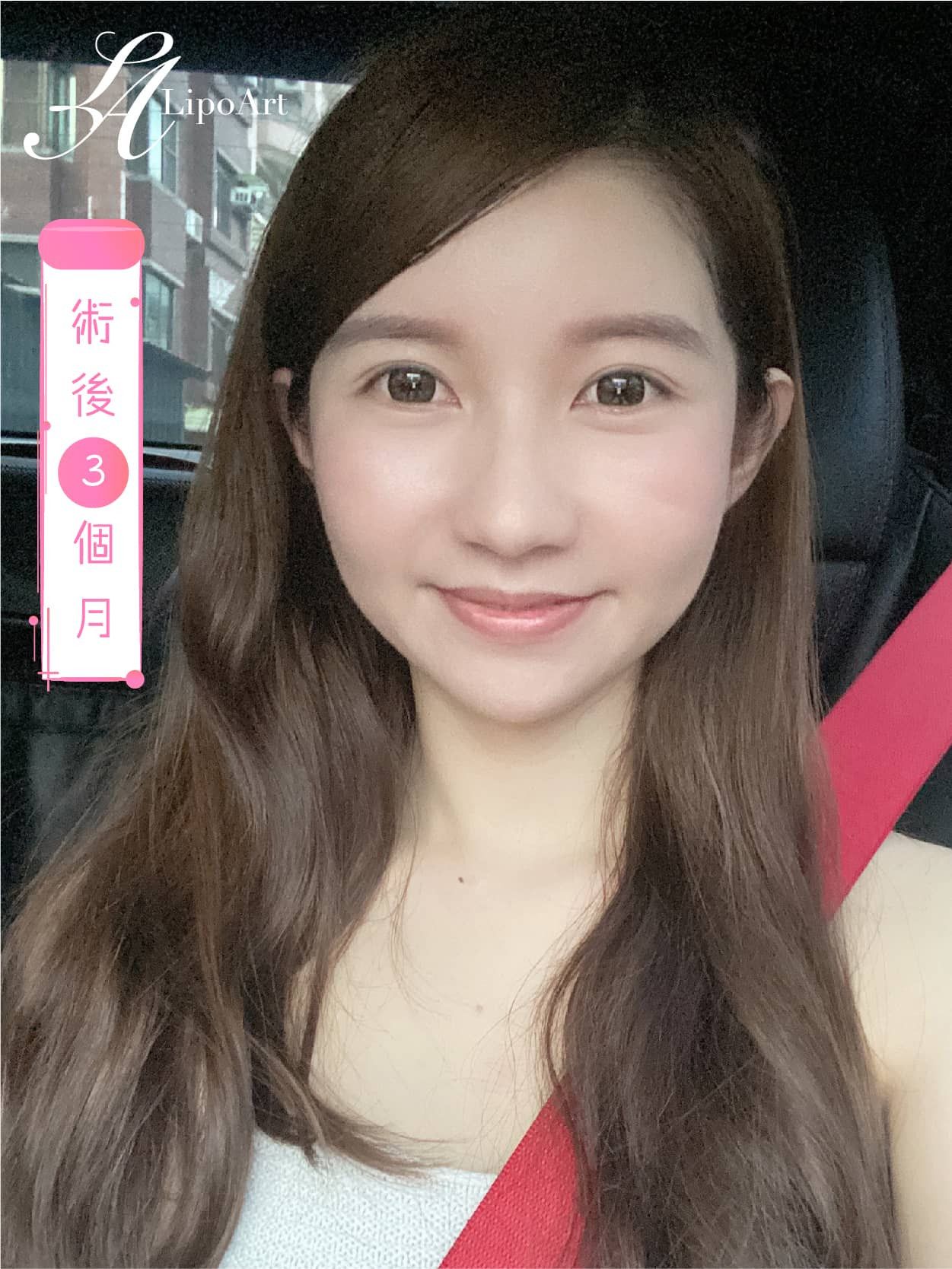 萊波亞