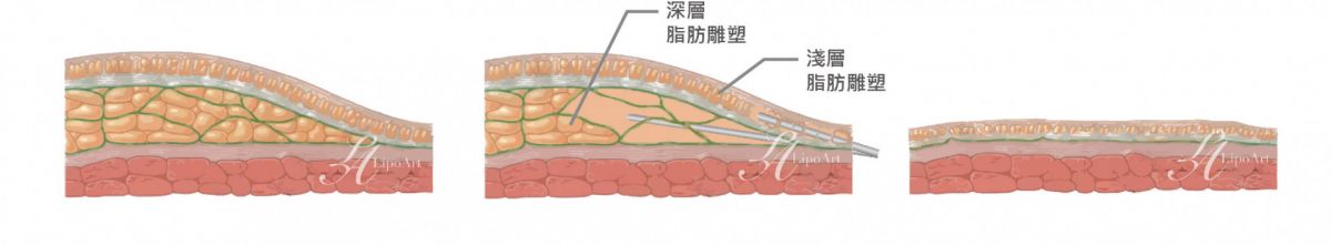 萊波亞