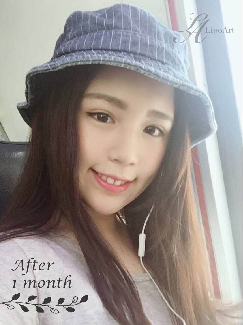 萊波亞