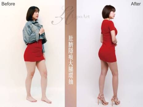 萊波亞 