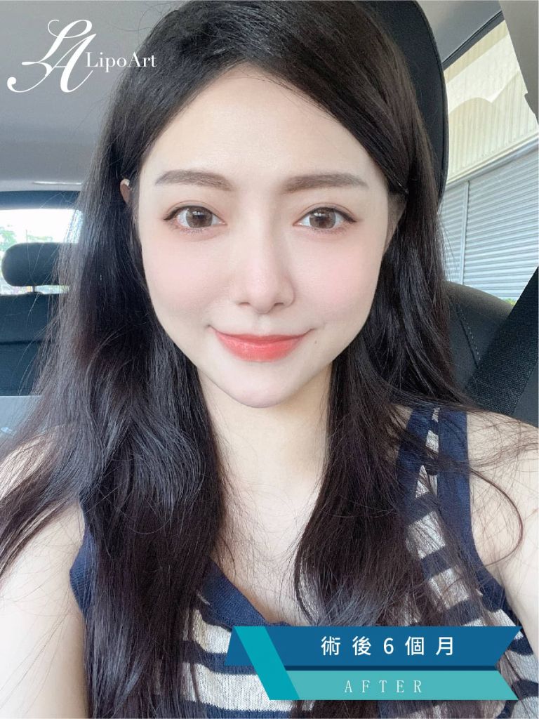 萊波亞