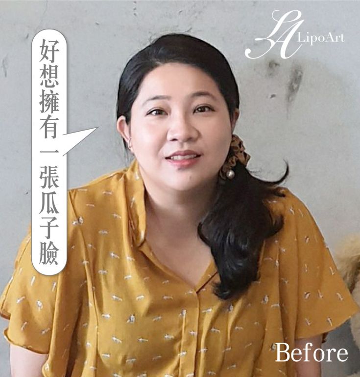 萊波亞