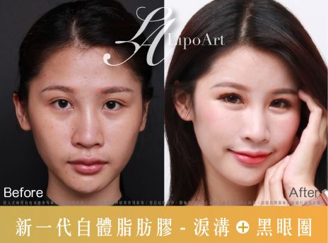萊波亞 