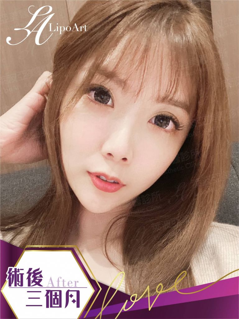萊波亞