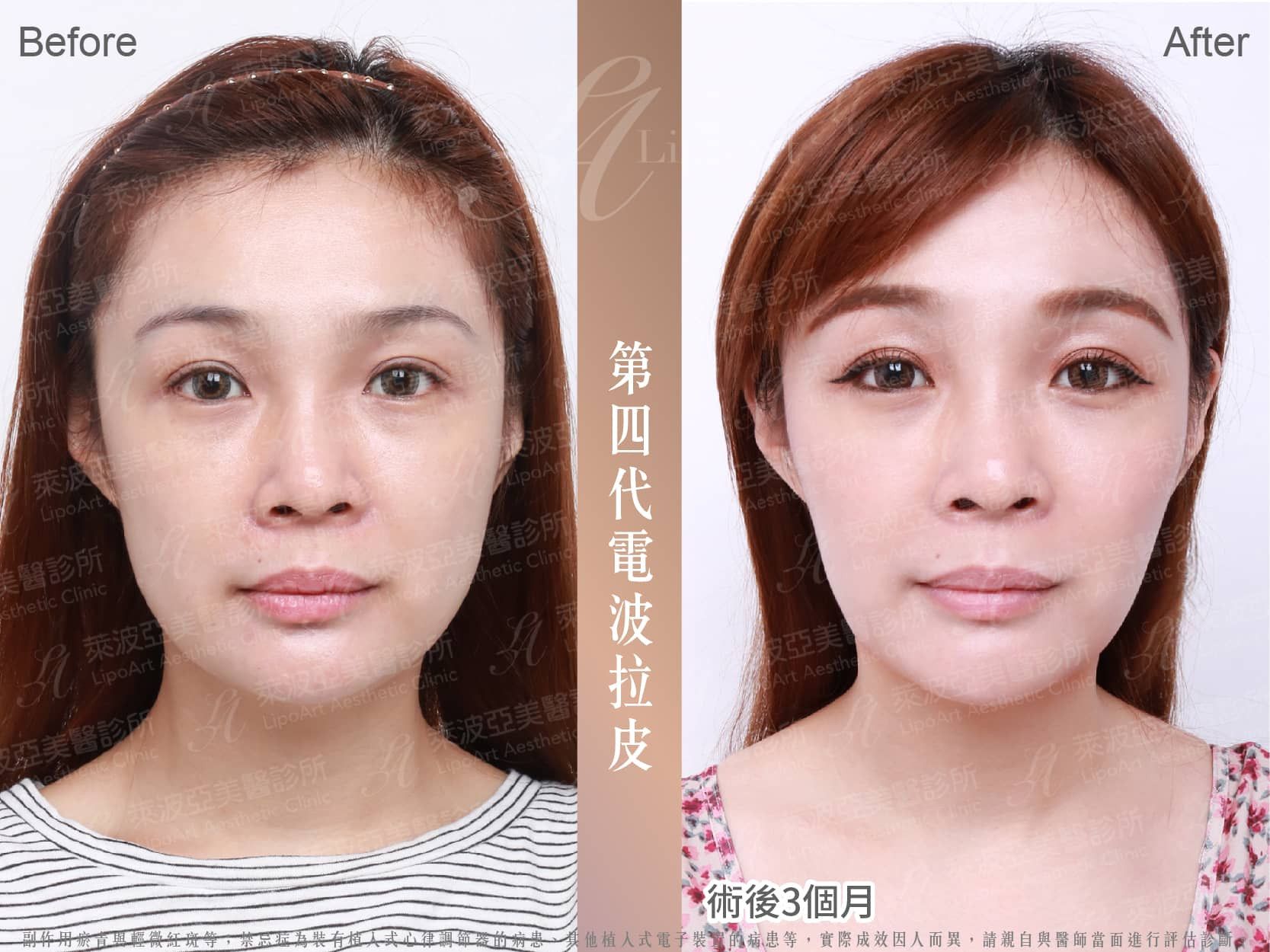 萊波亞 