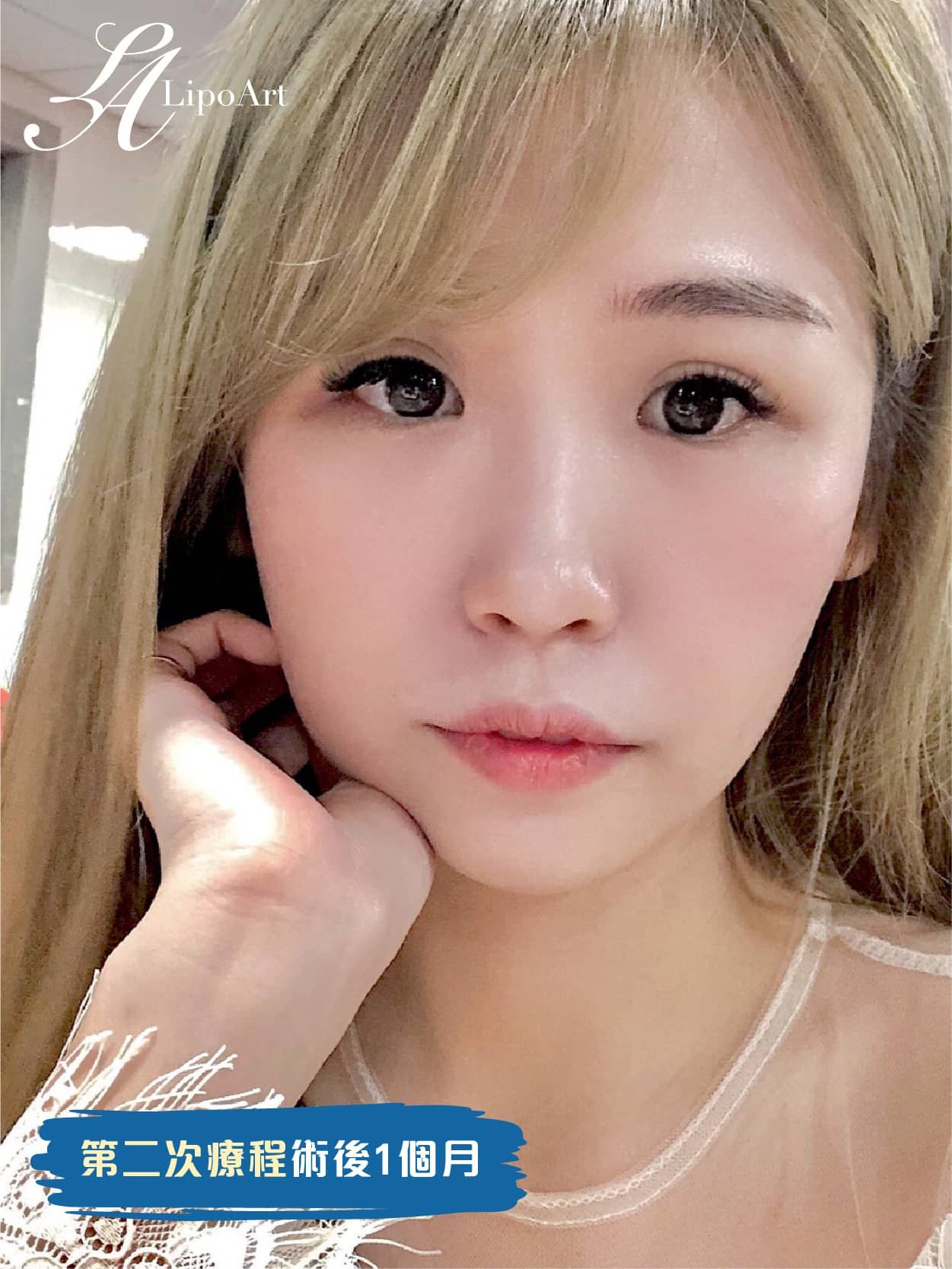 萊波亞