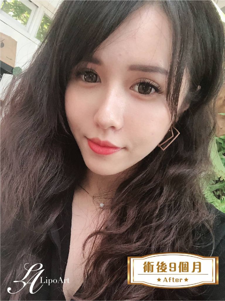 萊波亞