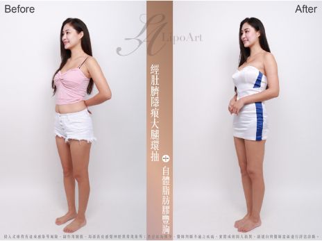 萊波亞 