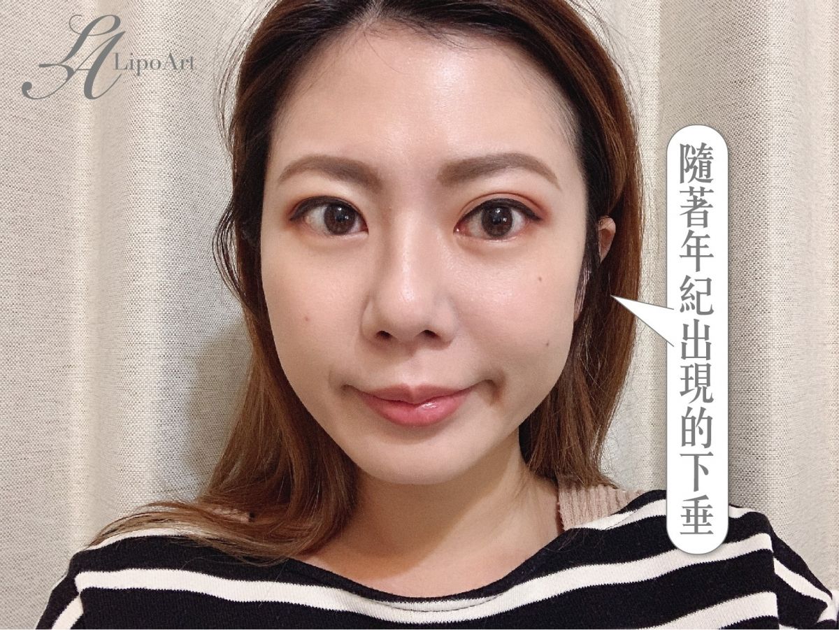 萊波亞