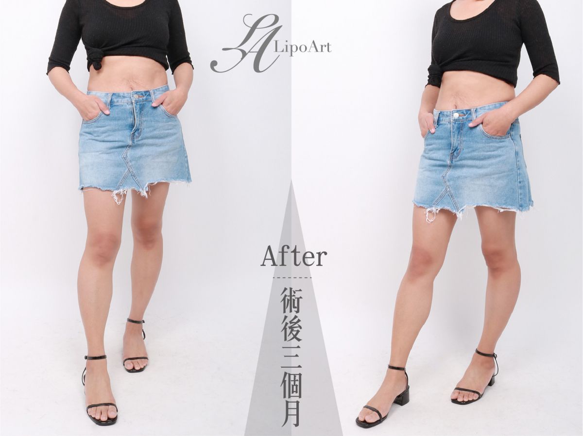 萊波亞