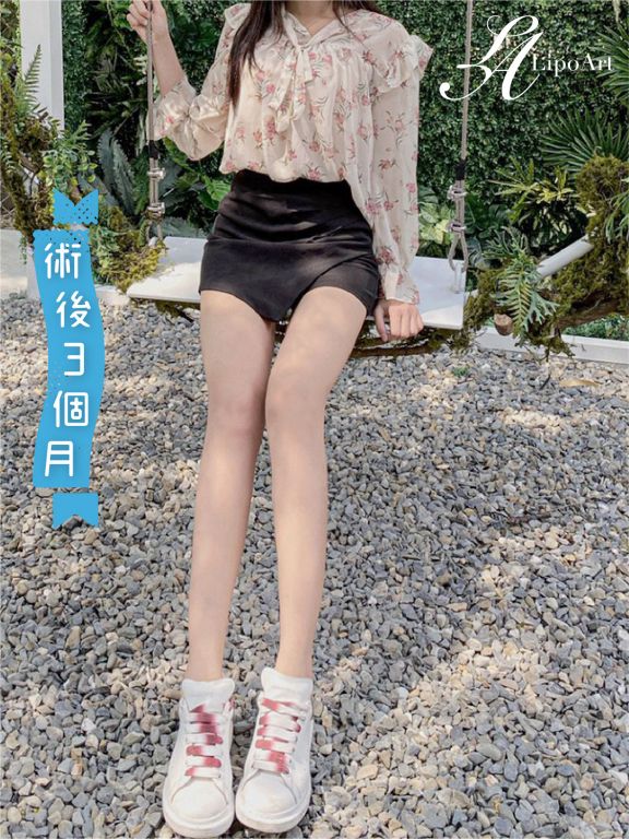 萊波亞