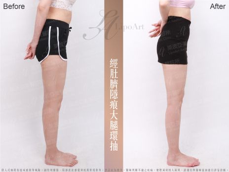 萊波亞