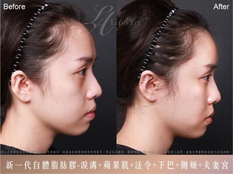 萊波亞 