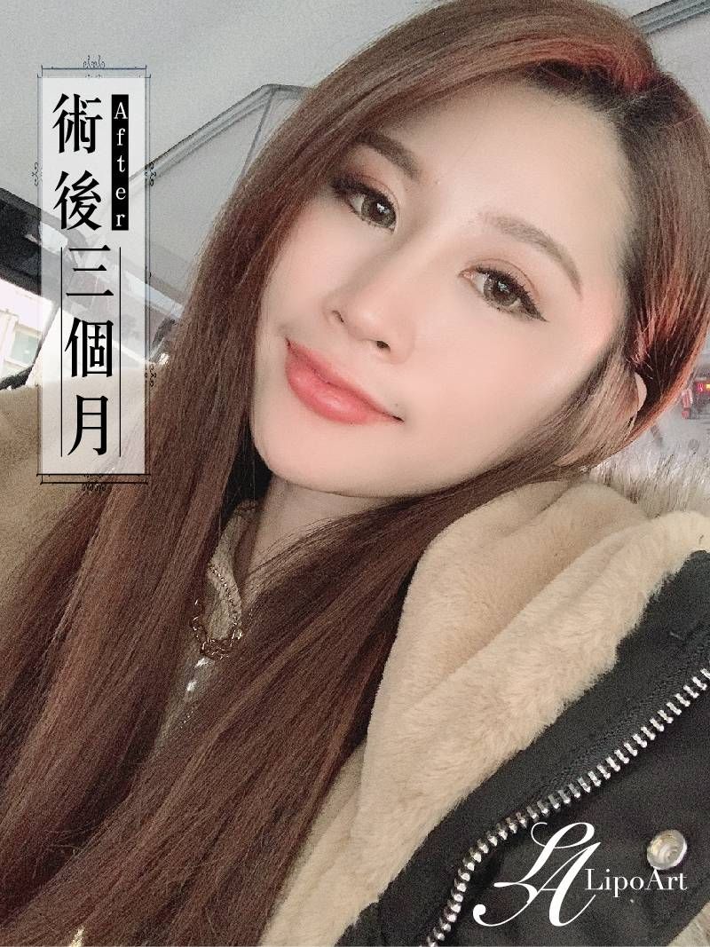 萊波亞