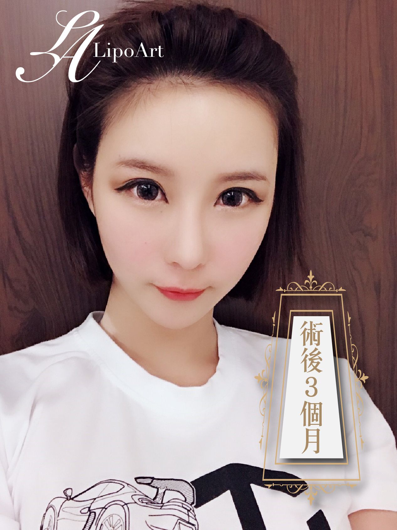 萊波亞