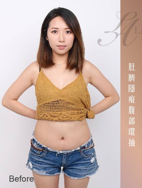 萊波亞