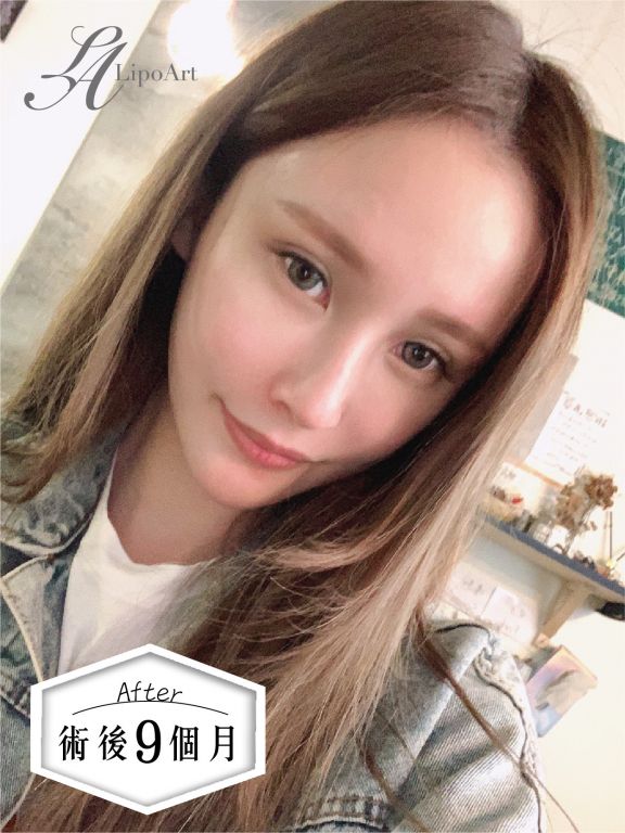 萊波亞