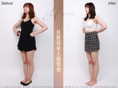 萊波亞 