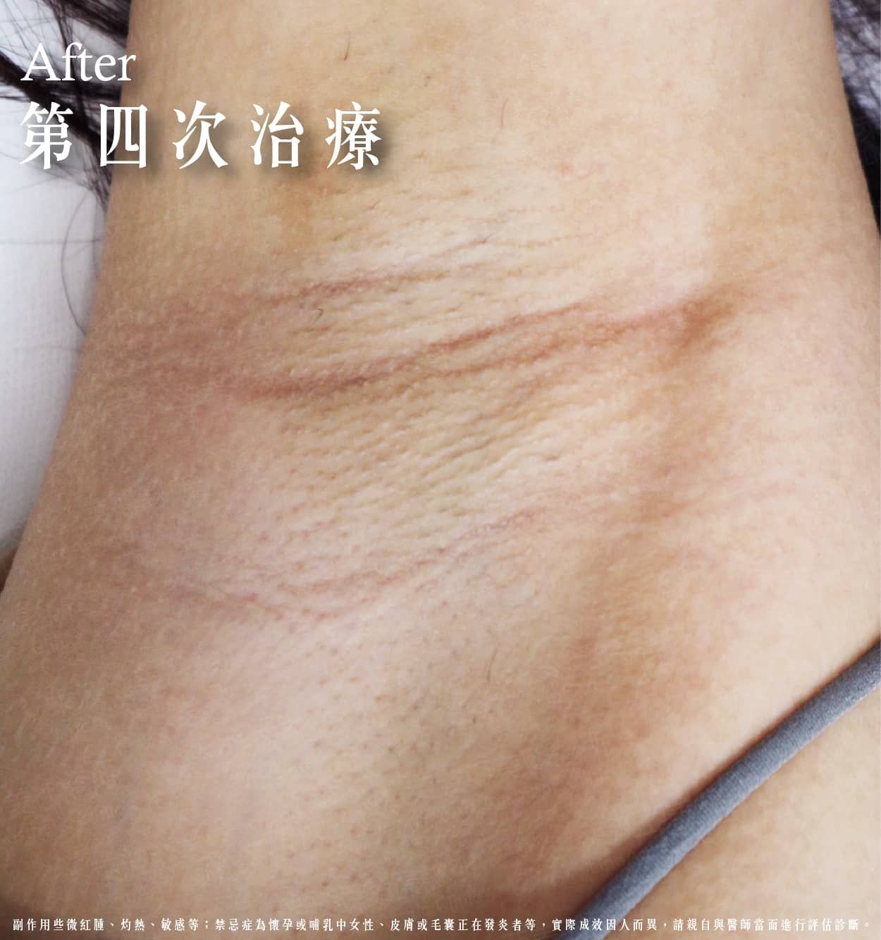 萊波亞