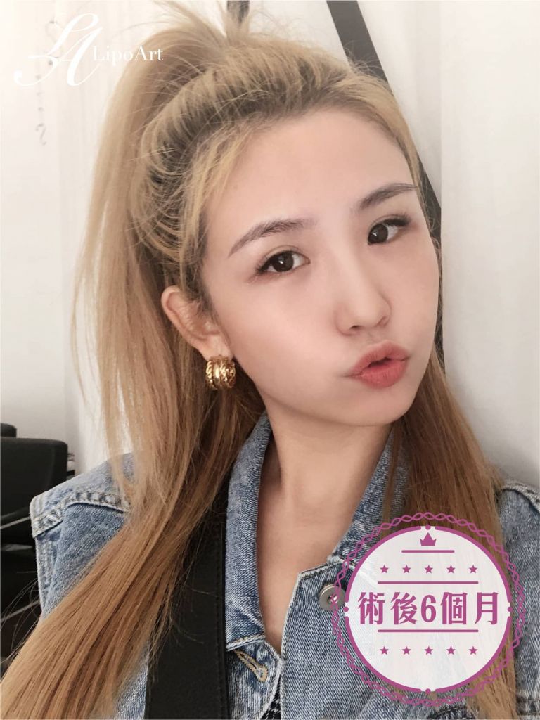 萊波亞