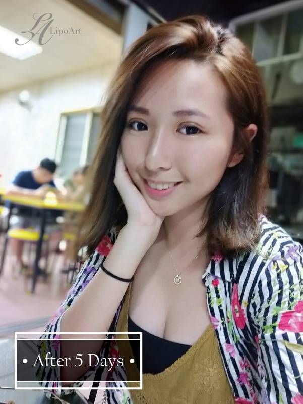 萊波亞