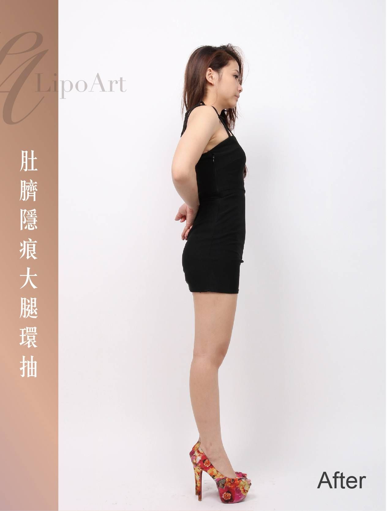 萊波亞 