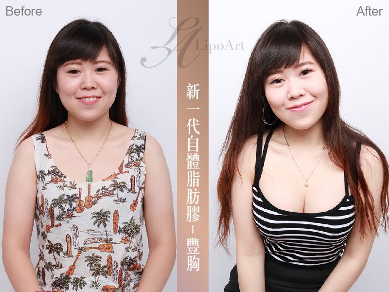 萊波亞