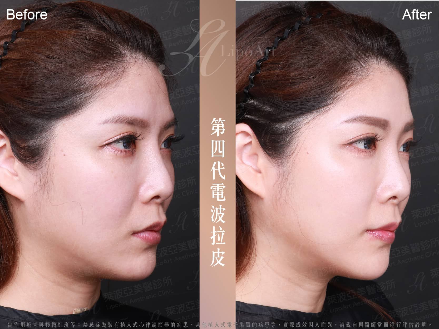 萊波亞 