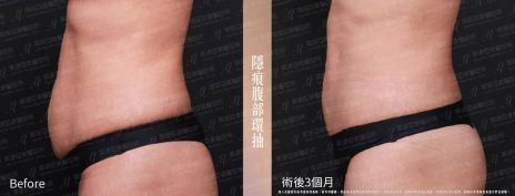 萊波亞 