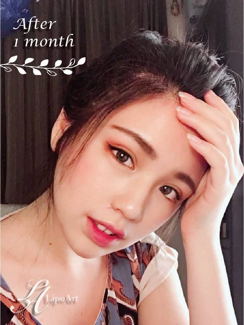 萊波亞