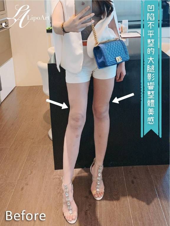 萊波亞