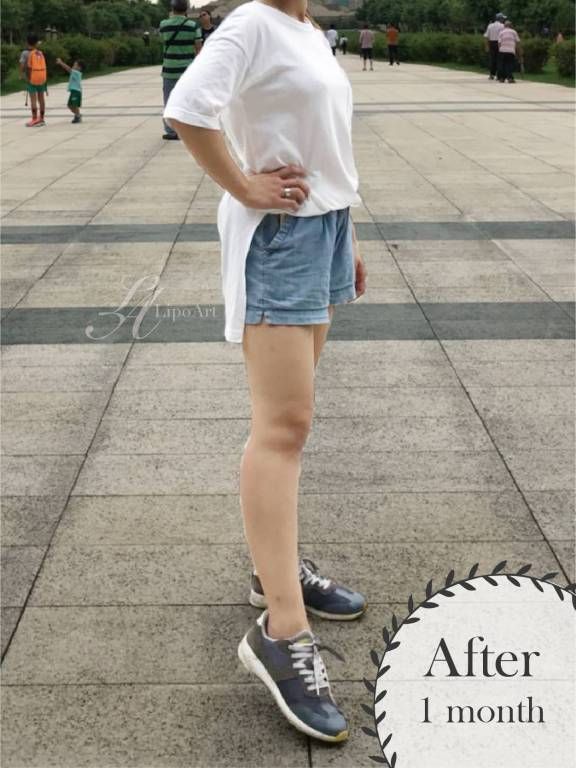 萊波亞