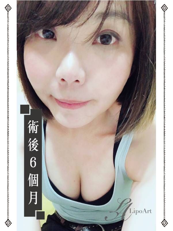 萊波亞