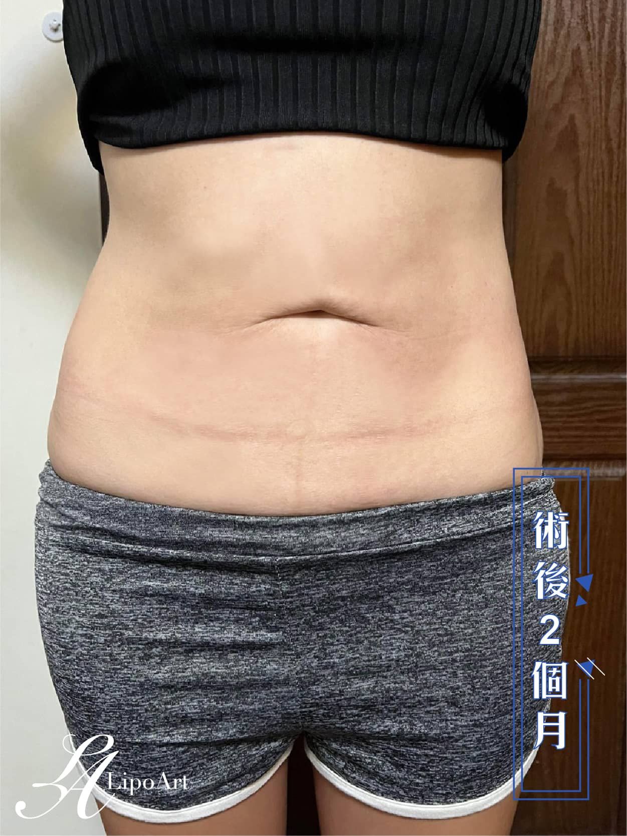 萊波亞