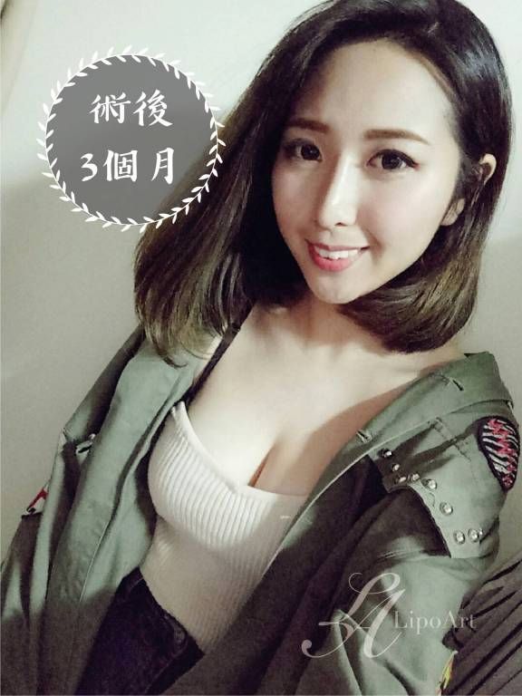 萊波亞