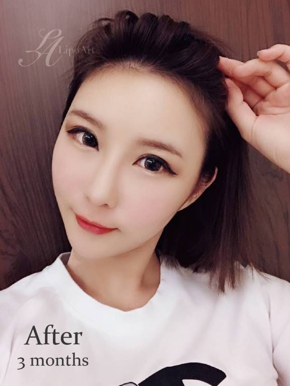 萊波亞