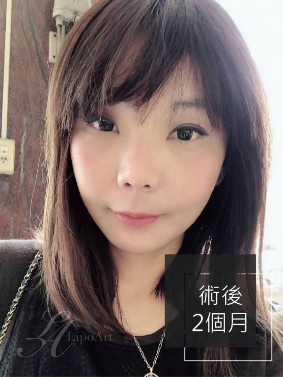 萊波亞