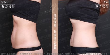 萊波亞