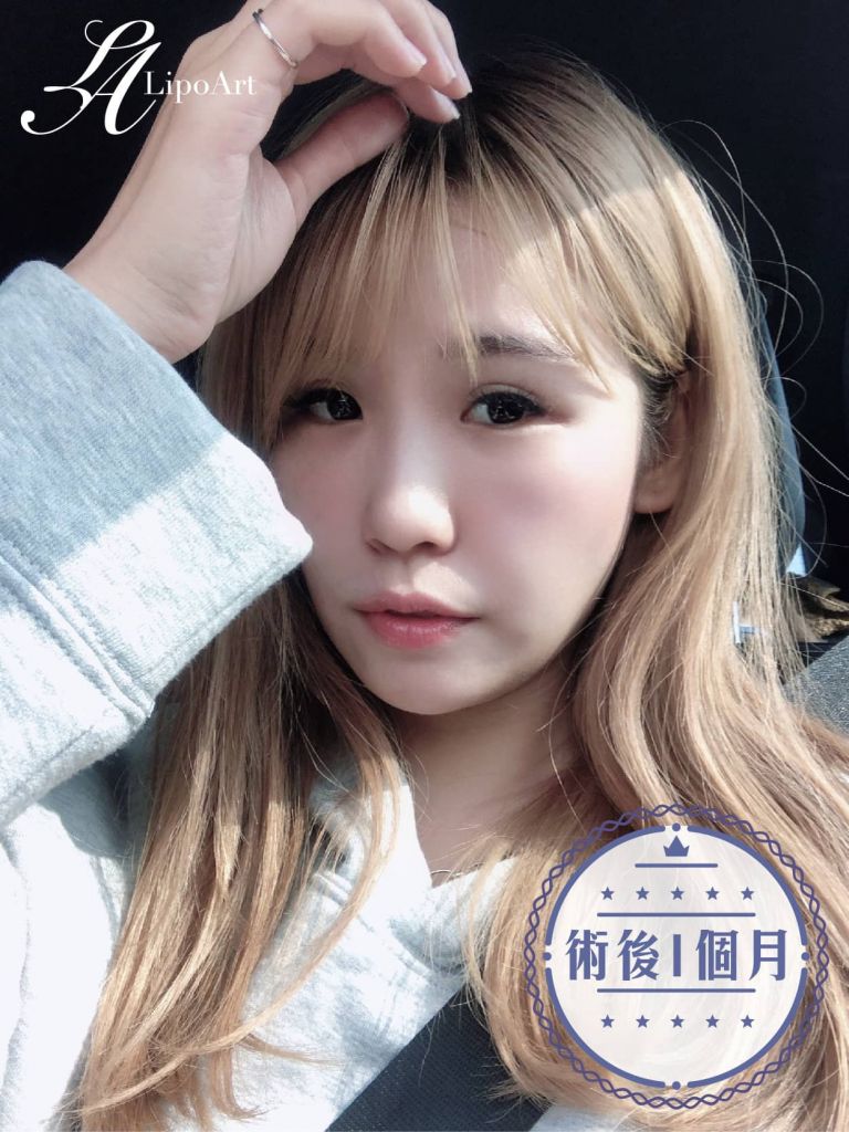 萊波亞