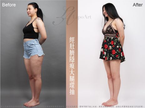 萊波亞 