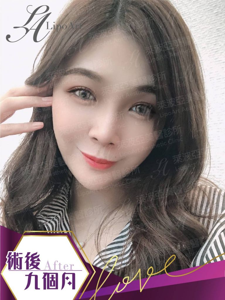 萊波亞