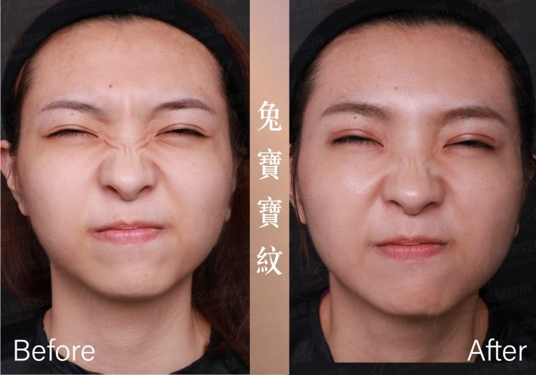 萊波亞