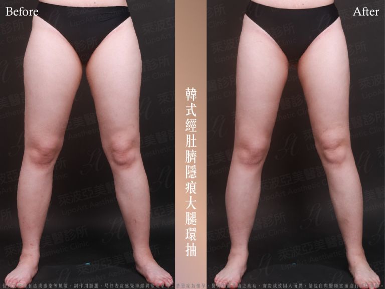 萊波亞