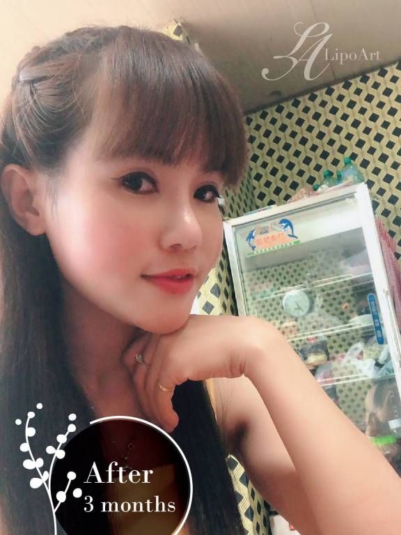 萊波亞