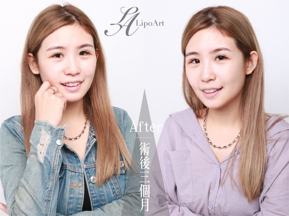 萊波亞