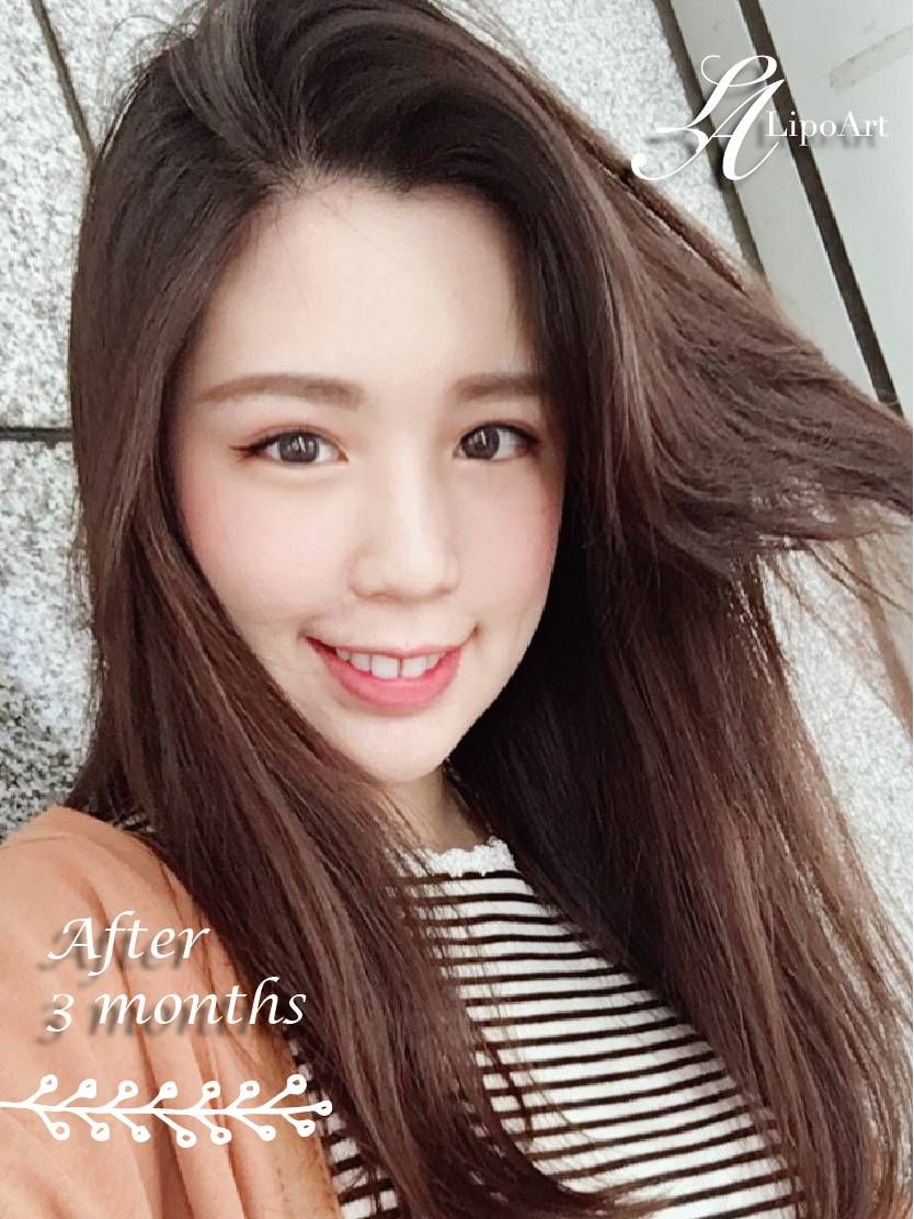 萊波亞